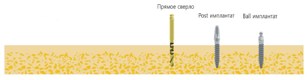 Хирургический набор ProTemKit